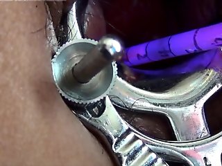 Advanced cervix play